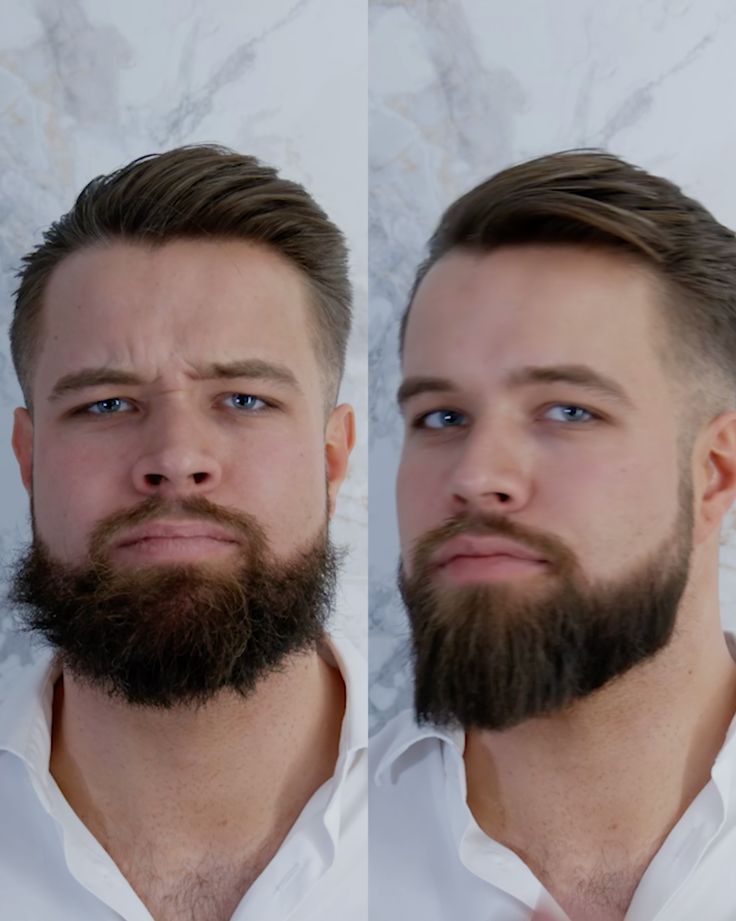 Beard Before
